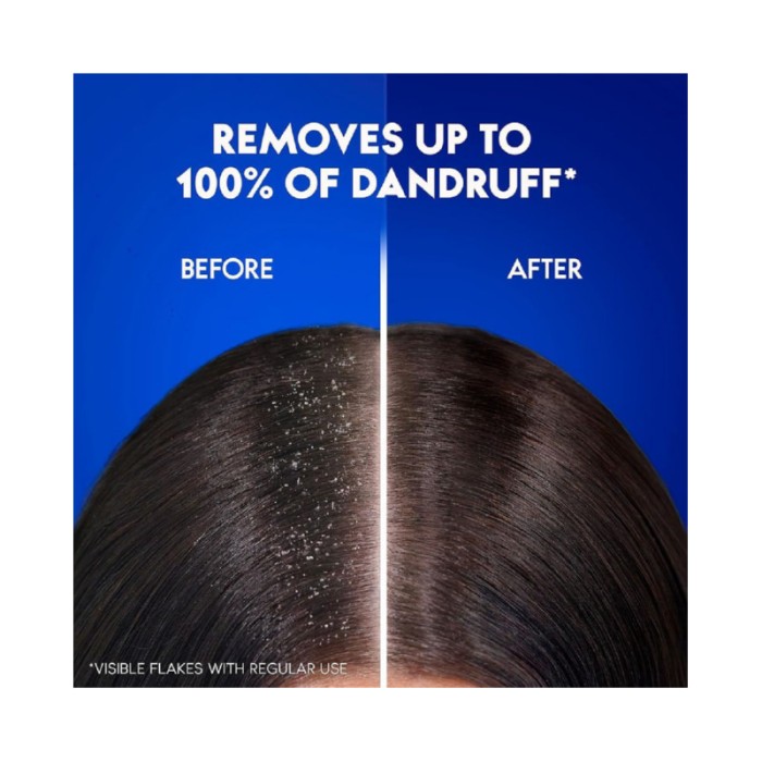 Head & Shoulders Charcoal Detox Anti - dandruff Shampoo With Piroctone Olamine 350ml Pack Of 2