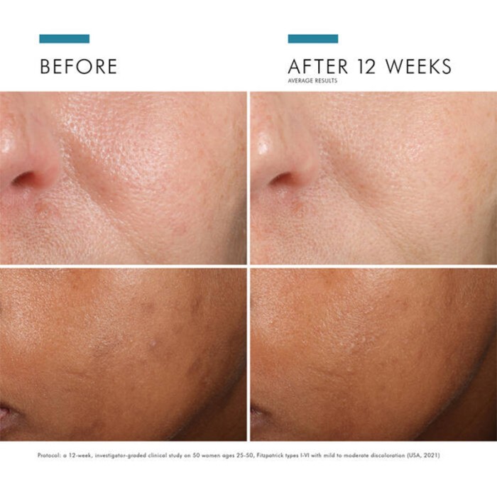 SkinCeuticals Phloretin CF 30ml