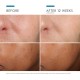 SkinCeuticals Phloretin CF 30ml